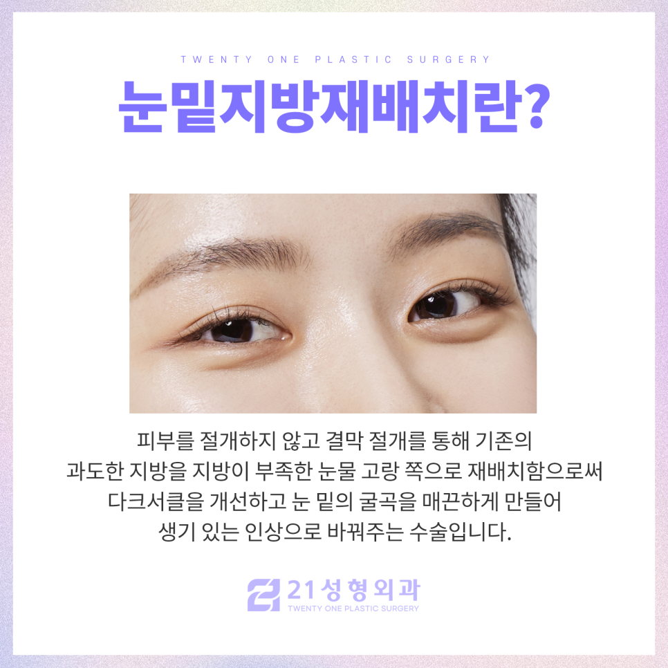 눈밑지방재배치수술잘하는곳 21성형외과에서 관련 이미지 2