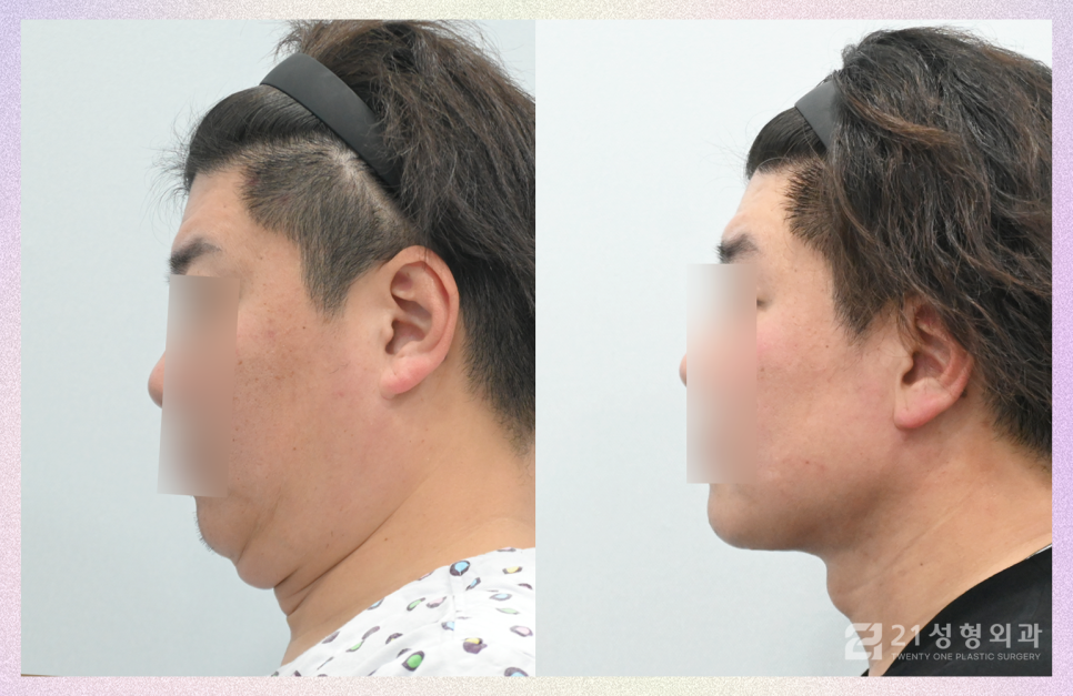 21성형외과에 사연을 들려주세요 관련 이미지 7