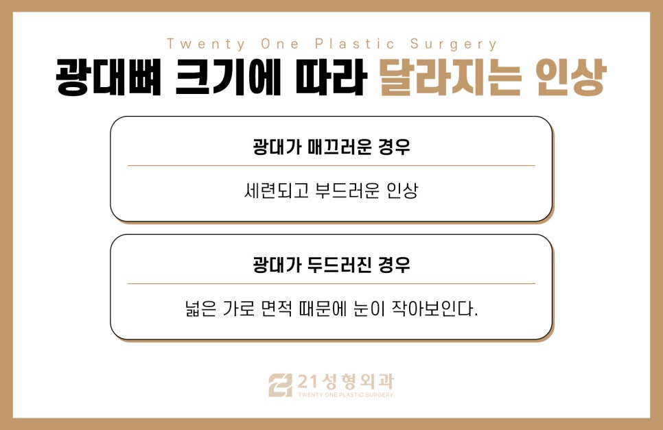남자광대축소술 울퉁불퉁한 라인을 매끄럽게 관련 이미지 3