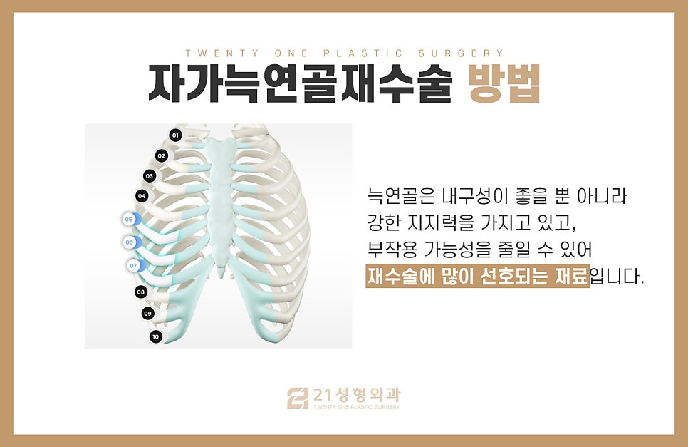 자가늑연골재수술 만족도를 높이는 포인트 관련 이미지 5