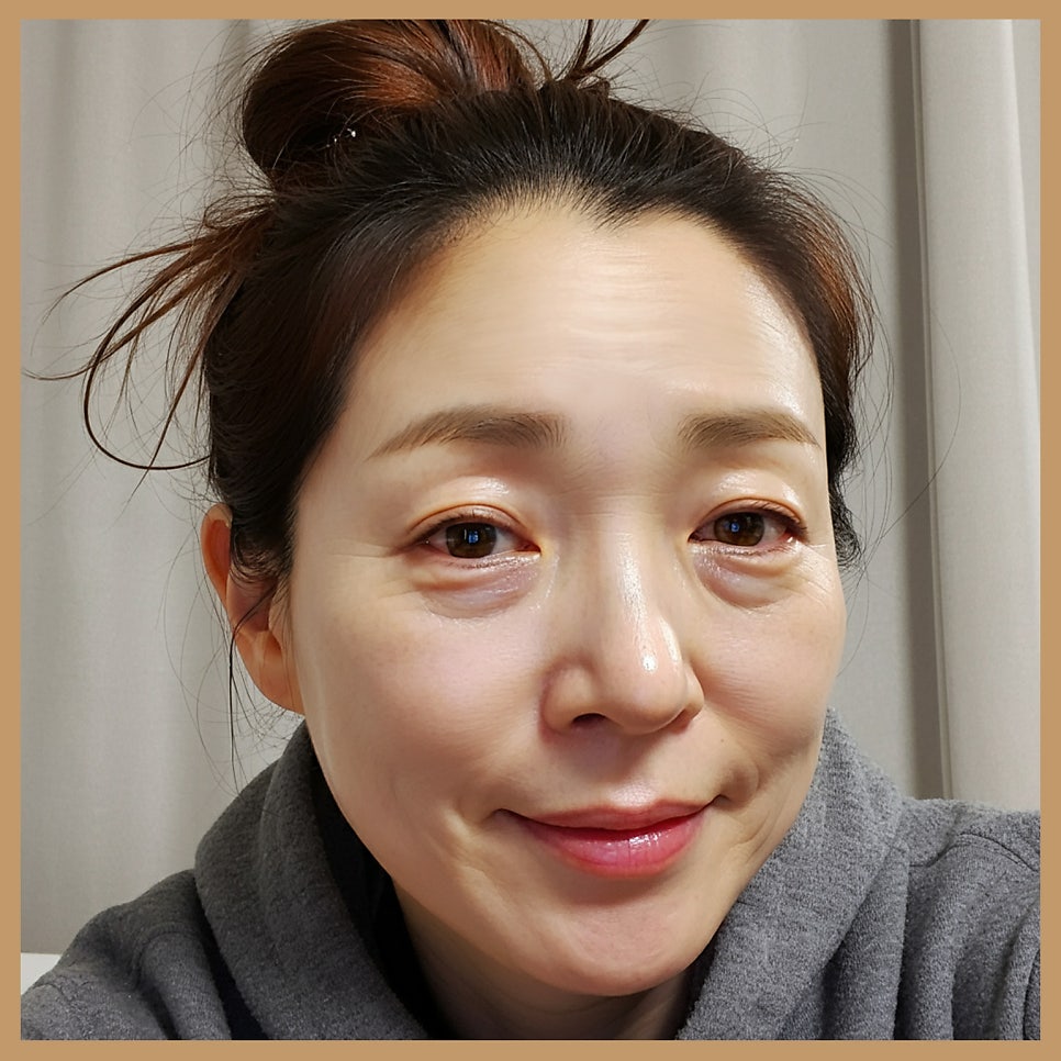 중년하안검 흉터 미리 방지 가능합니다 관련 이미지 3