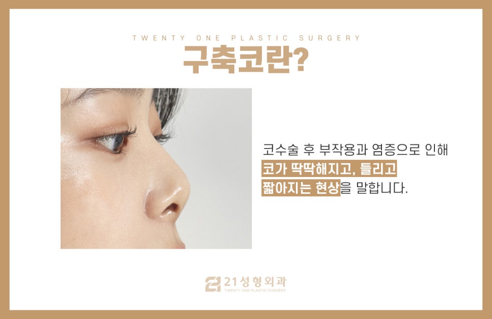 자가늑연골재수술 만족도를 높이는 포인트 관련 이미지 4