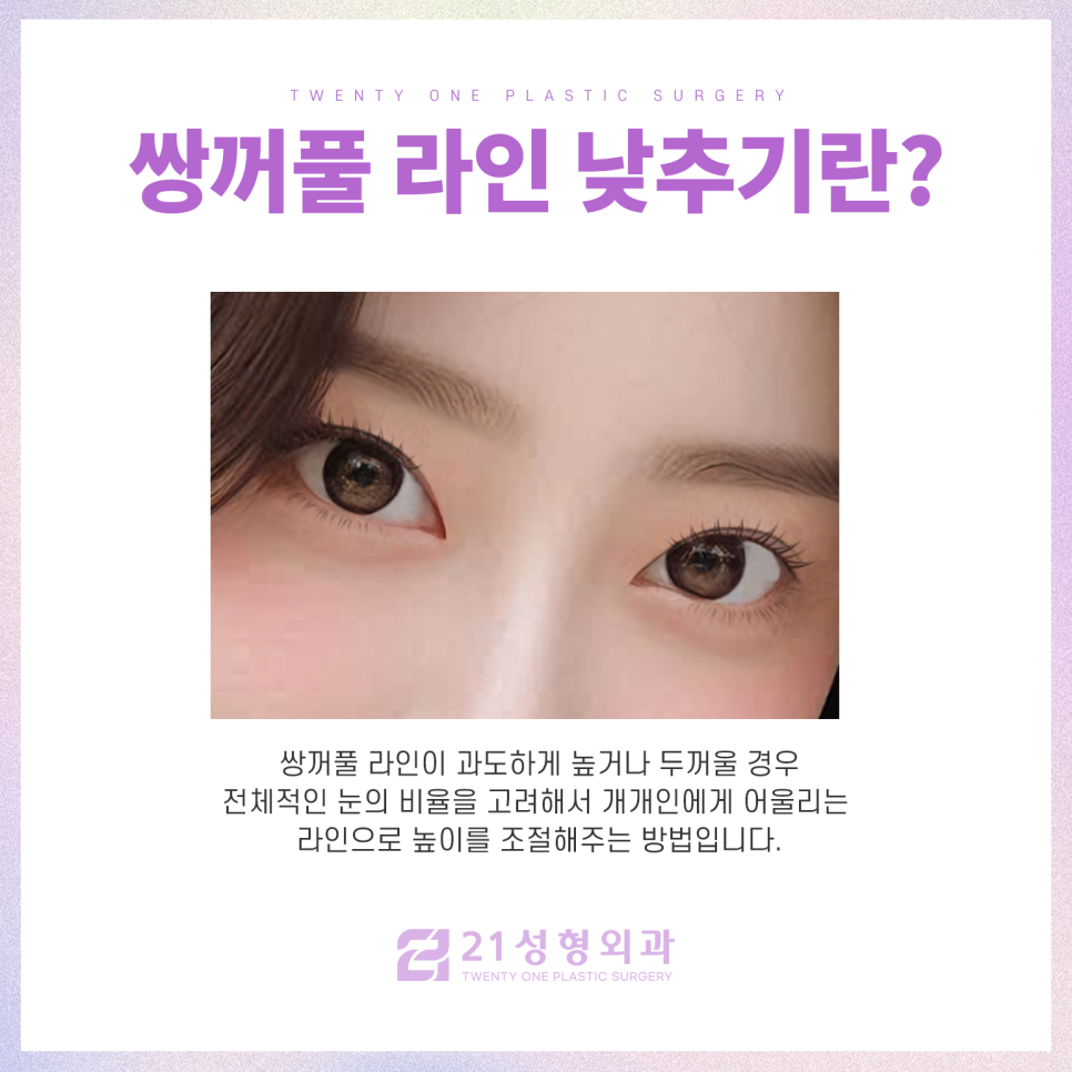 라인낮추기 쌍꺼풀의 자연스러움을 고려하여 관련 이미지 3