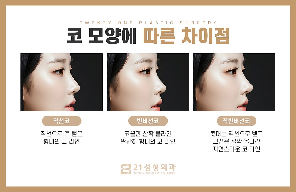 반버선코수술 쉽게 알아보는 방법 관련 이미지 3