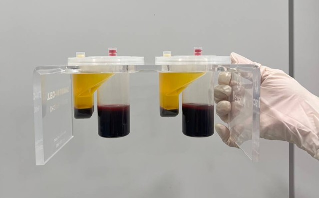 Stem Cells: Why Are They Drawing Attention for Fatigue and Low Energy? image 5