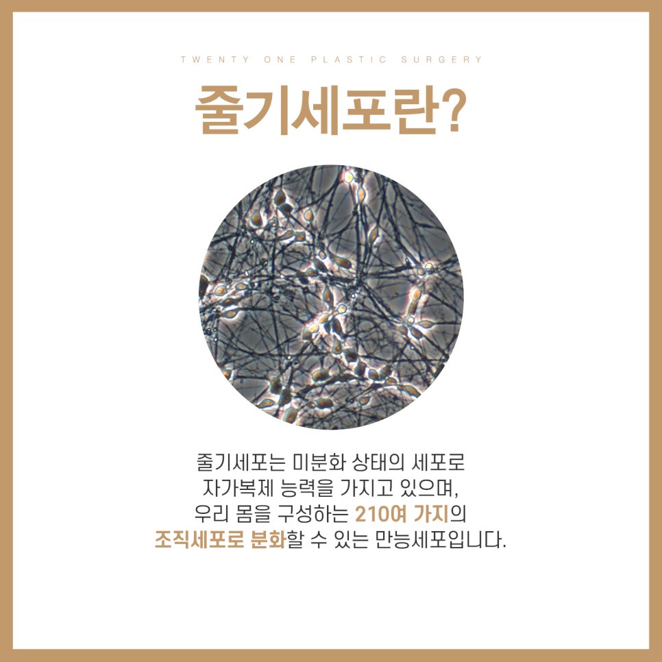 줄기세포애교지방이식으로 카리나 애굣살 만들기 관련 이미지 2
