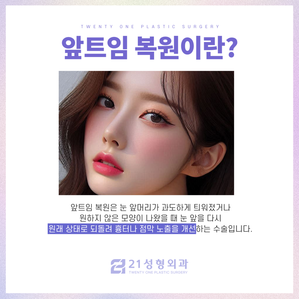 앞트임복원수술 자연스러운 눈매로 재탄생 관련 이미지 3