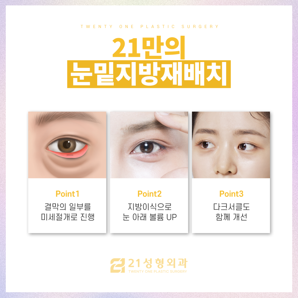 강남눈밑지방재배치잘하는곳 처지고 밋밋한 눈매 관리 관련 이미지 4