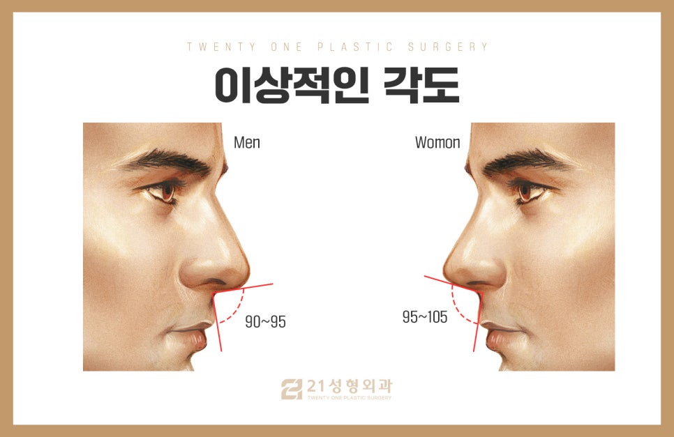 비순각교정만으로로 양악 효과 만들 수 있습니다 관련 이미지 3