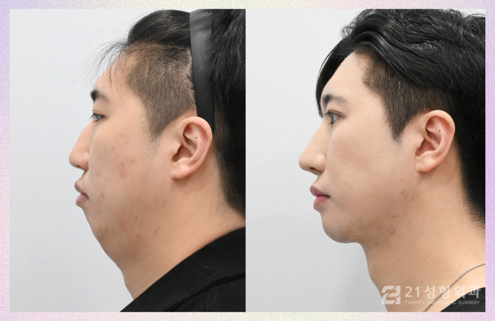 21성형외과에 사연을 들려주세요 관련 이미지 4