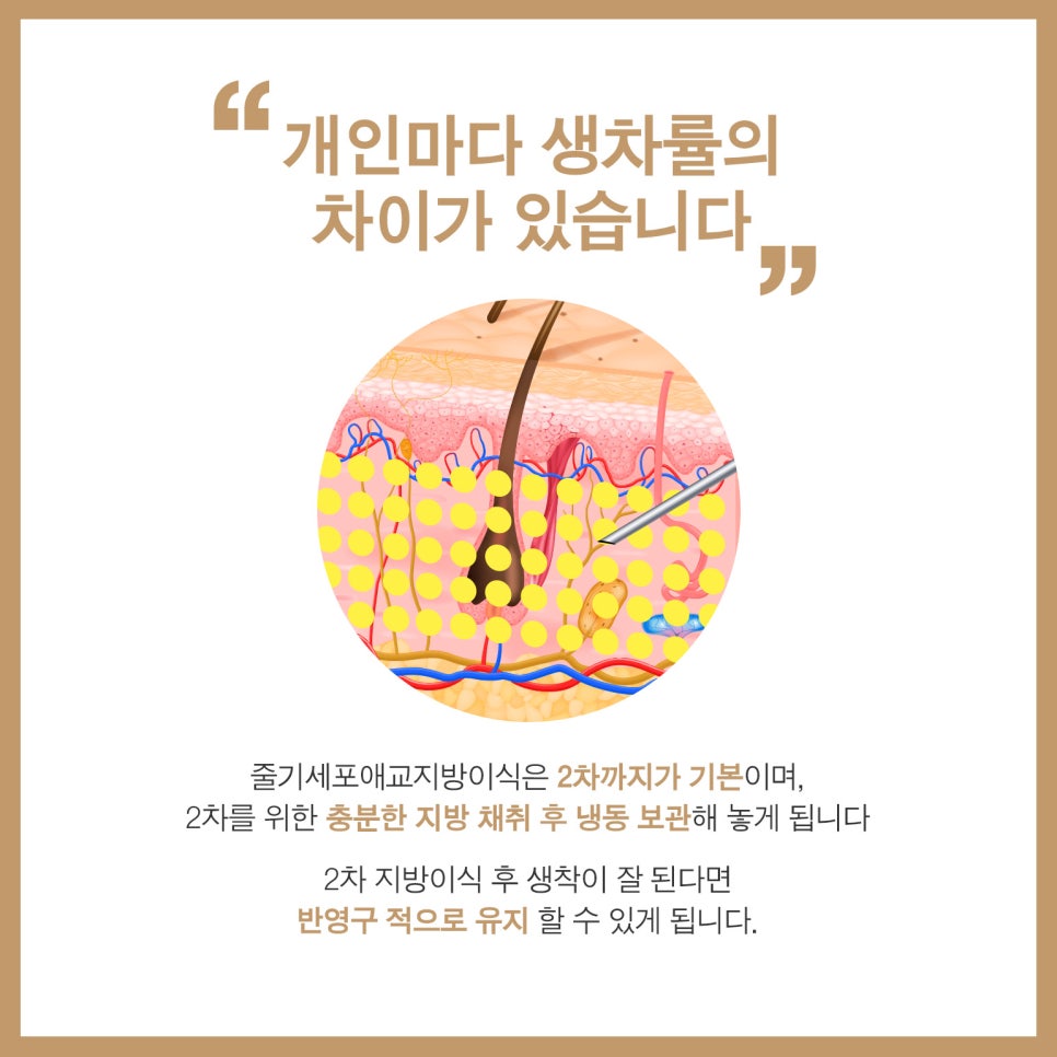 줄기세포애교지방이식으로 카리나 애굣살 만들기 관련 이미지 6