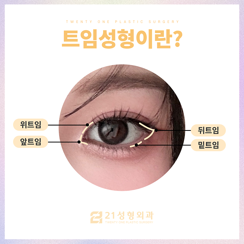 눈트임성형으로 크고 선명하게 관련 이미지 4