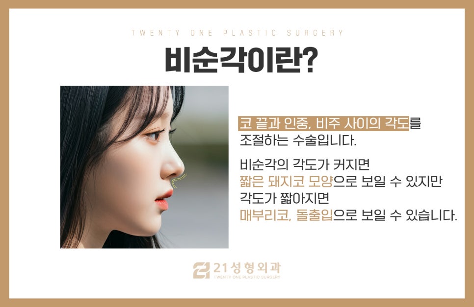 비순각교정만으로로 양악 효과 만들 수 있습니다 관련 이미지 2