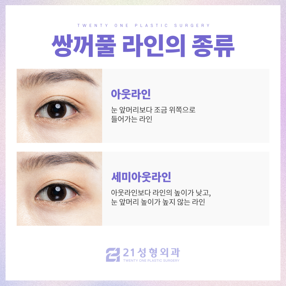 강남성형외과쌍꺼풀을 고민 중이라면 관련 이미지 4