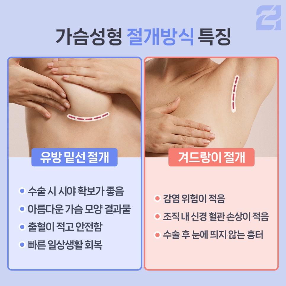 유방확대술 후 피주머니 착용 관련 이미지 5