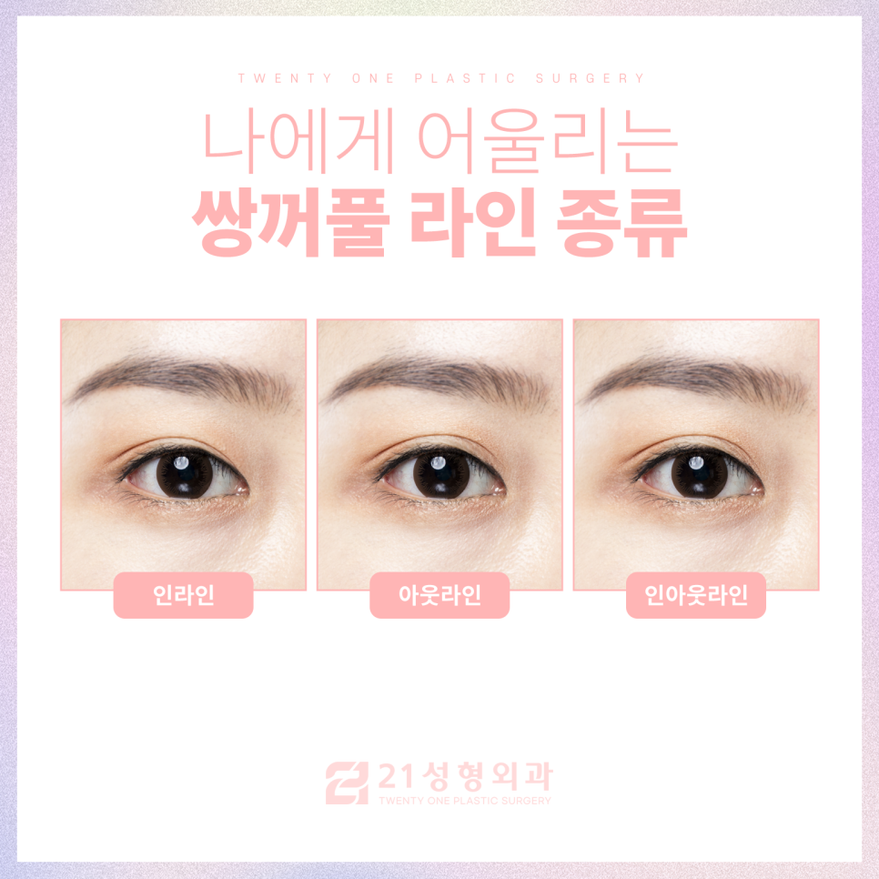 강남눈성형잘하는곳 차이점은 관련 이미지 3