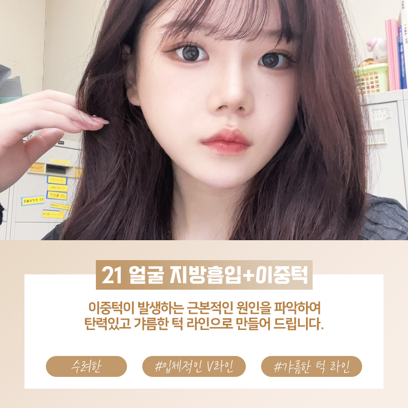 21성형외과리얼모델모집 상시 모집 진행 관련 이미지 4