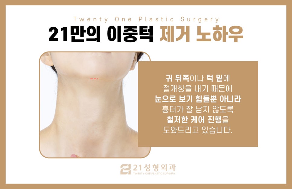 턱살제거수술로 매끈한 V라인 관련 이미지 7
