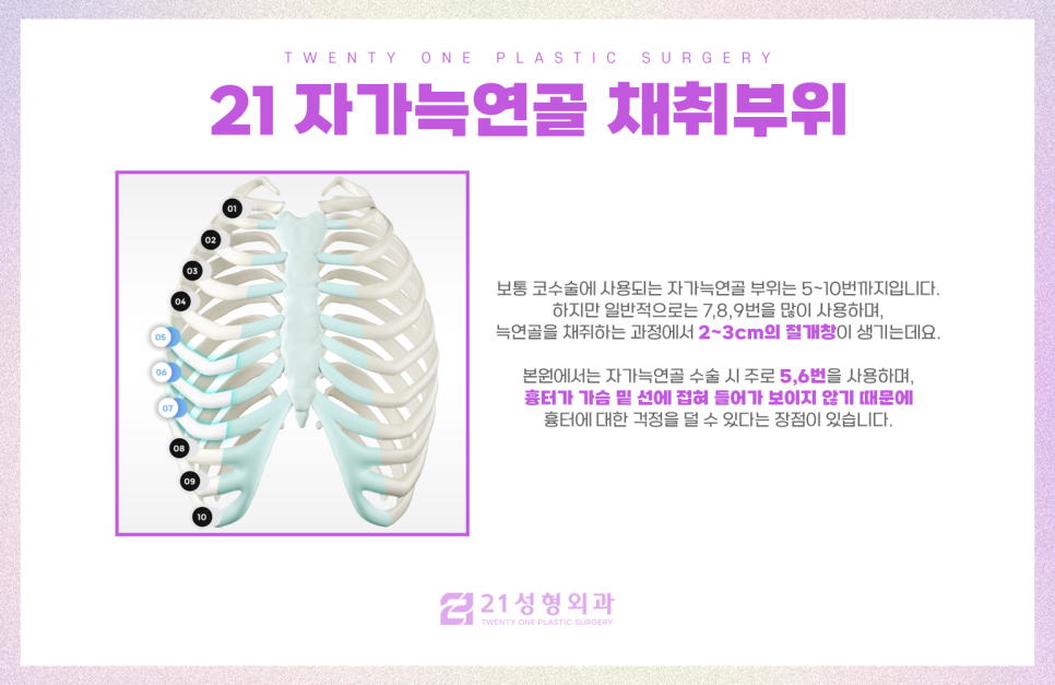 자가늑연골재수술은 이십일성형외과에서 꼼꼼하게 관련 이미지 4
