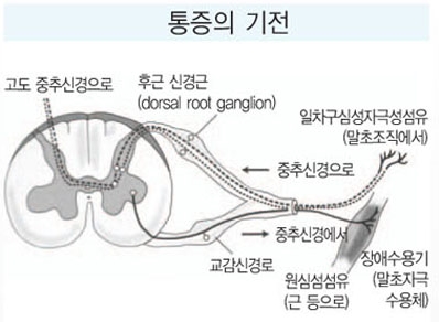[가슴 성형수술 후 통증] 두려운 통증 관리 및 예방은? 관련 이미지 4