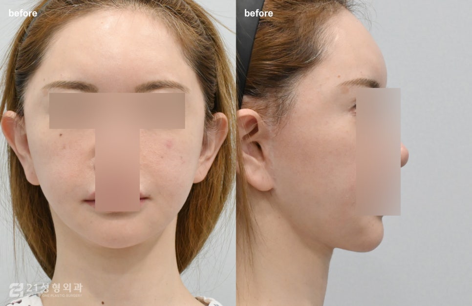 Is a Small Face and a Slim Face Shape Like Jennie’s Really Possible? image 6