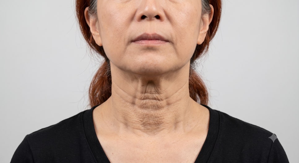 That Posture You Use While Looking at Your Smartphone—Half of Your Neck Wrinkles Start There. — 21 Plastic Surgery Neck Wrinkle Treatment image 2