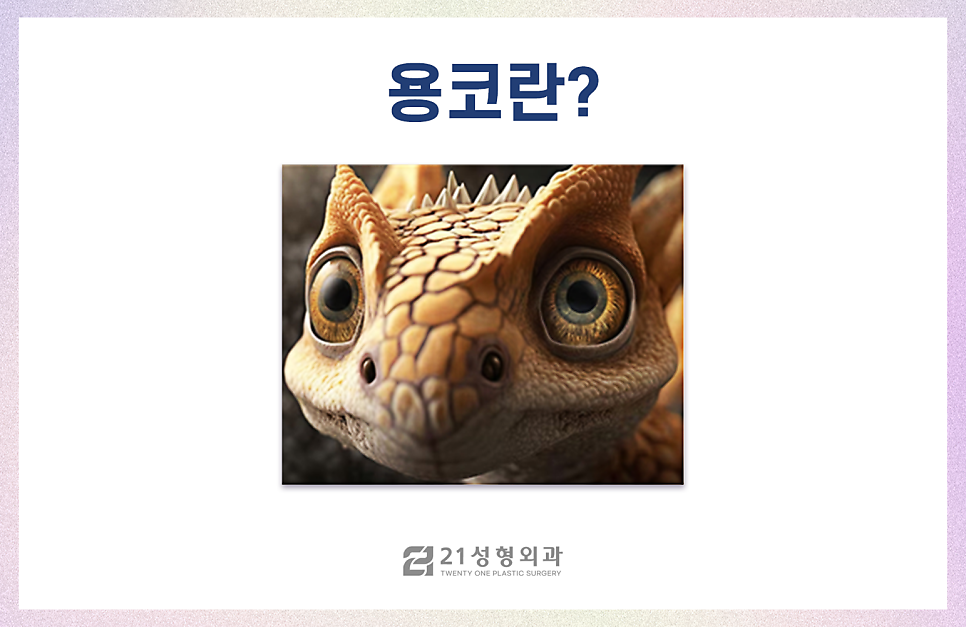 코성형잘하는곳 전체적인 비율을 고려해야 관련 이미지 3