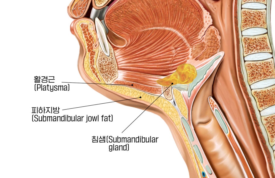 Is simple liposuction enough for double chin surgery? image 1