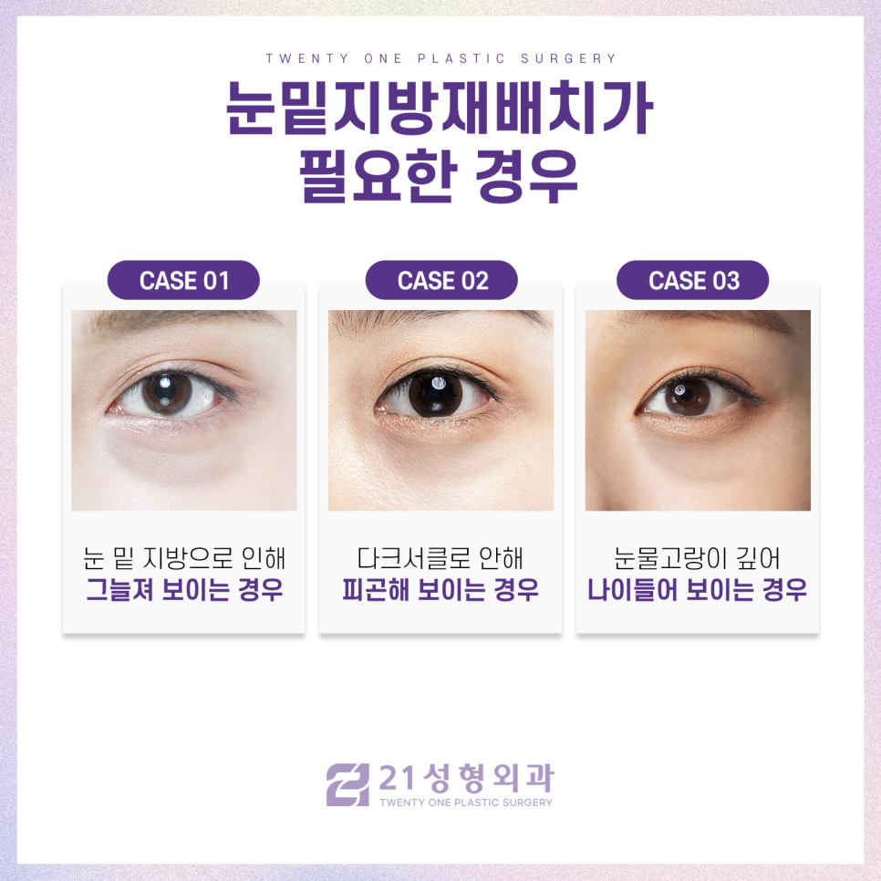 강남눈밑지방재배치잘하는곳 다른 차이는 관련 이미지 3