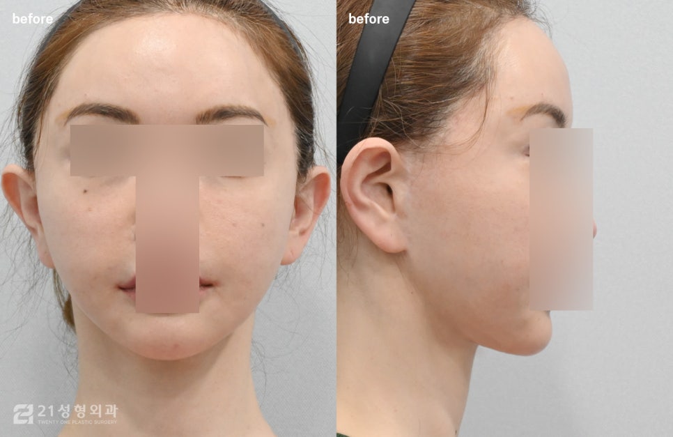 Is a Small Face and a Slim Face Shape Like Jennie’s Really Possible? image 7