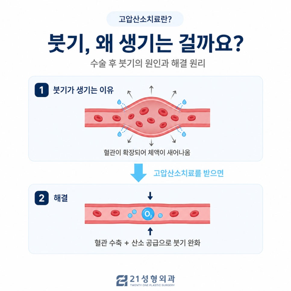 수술 후 붓기, 시간이 답이 아닙니다. — 관련 이미지 2