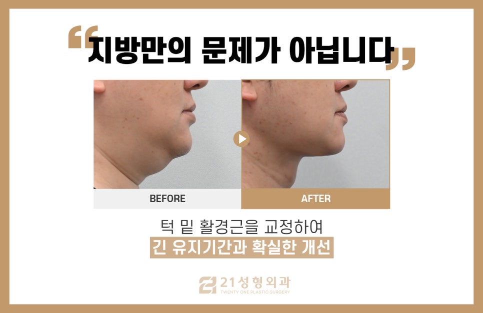이것만 하면 굳이 살 빼지 않아도 된다. 관련 이미지 5