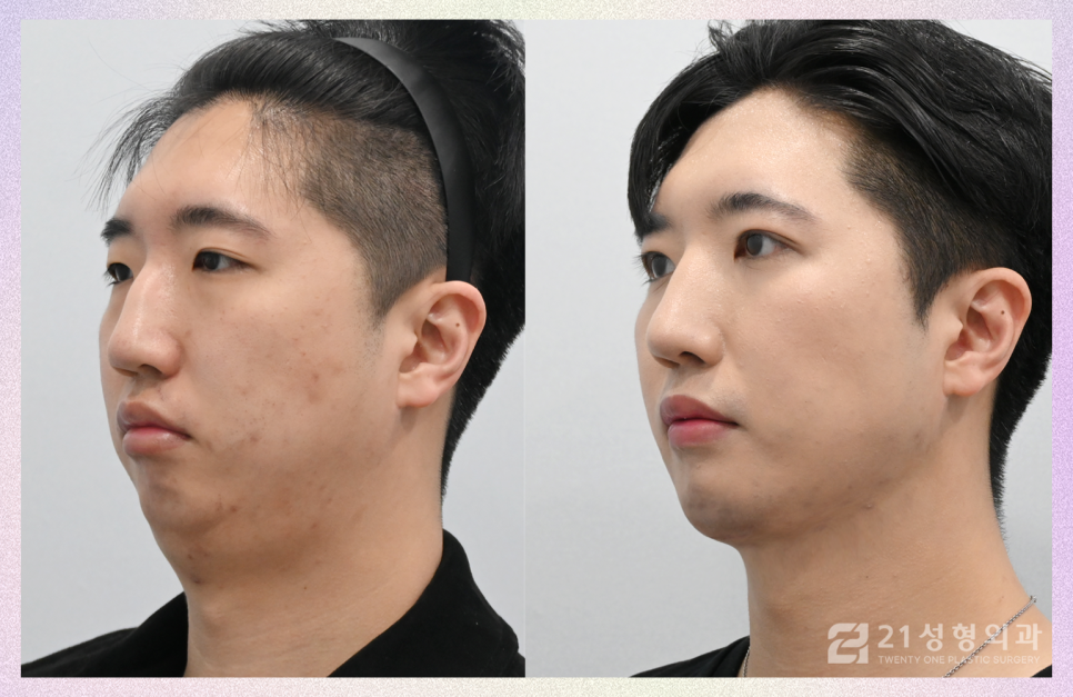 21성형외과에 사연을 들려주세요 관련 이미지 3