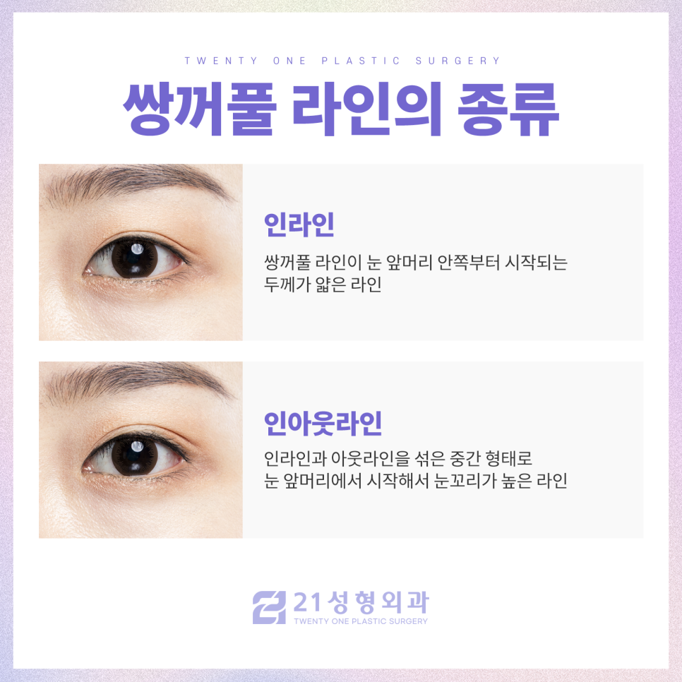 강남성형외과쌍꺼풀을 고민 중이라면 관련 이미지 3