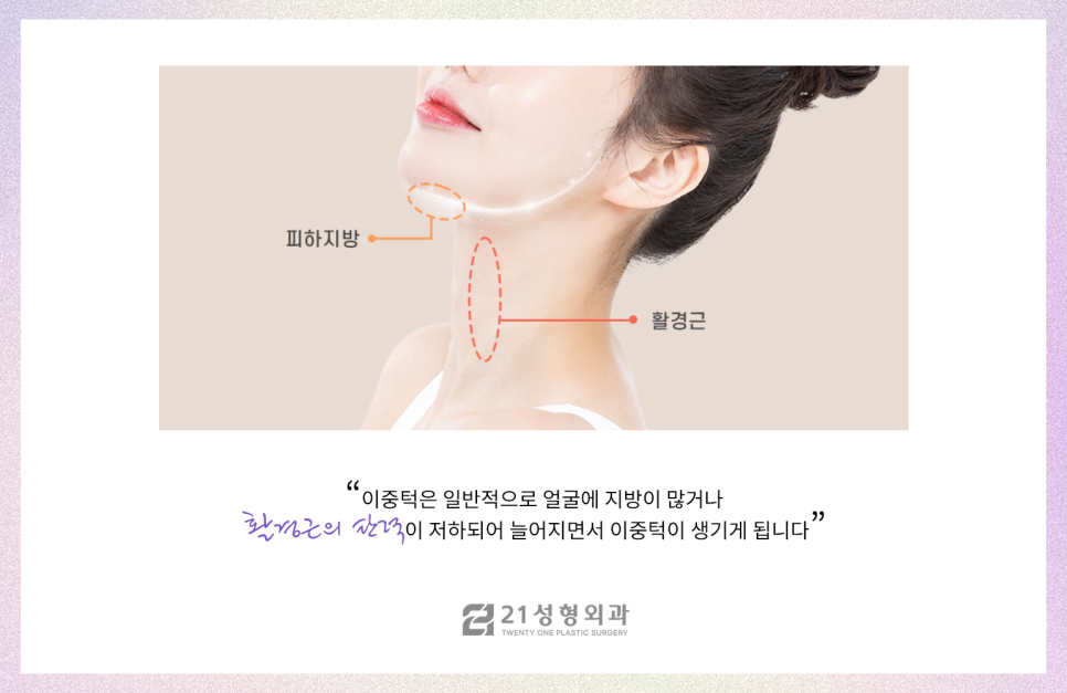 이중턱지방제거 콤플렉스라면 관련 이미지 3