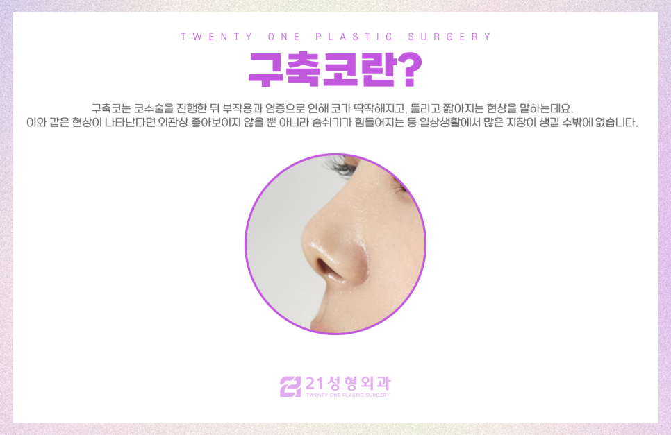 자가늑연골재수술은 이십일성형외과에서 꼼꼼하게 관련 이미지 3