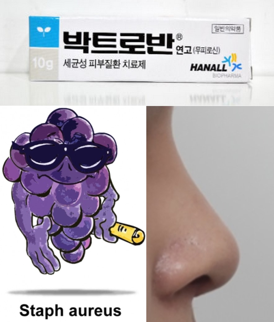 기타 항균제 관련 이미지 11