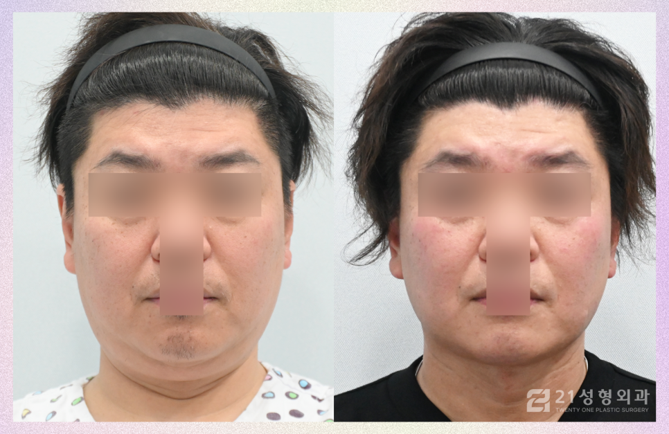 21성형외과에 사연을 들려주세요 관련 이미지 5