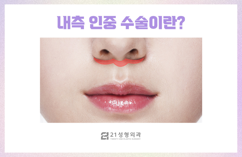 강남인중성형만으로 중안부 줄이기 관련 이미지 6