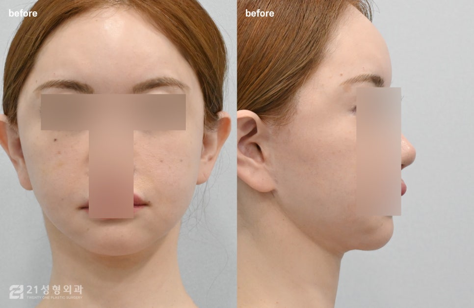 Is a Small Face and a Slim Face Shape Like Jennie’s Really Possible? image 5