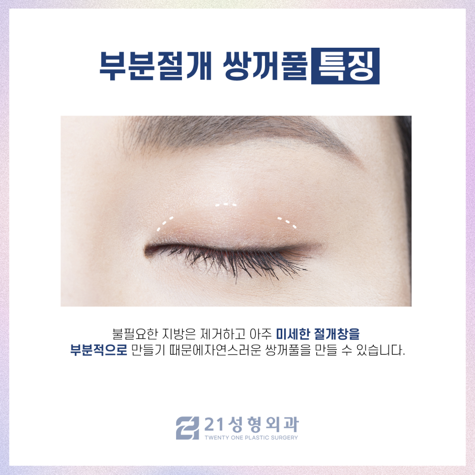 쌍꺼풀절개수술 안검하수를 효과적으로 개선하는 방법 관련 이미지 3