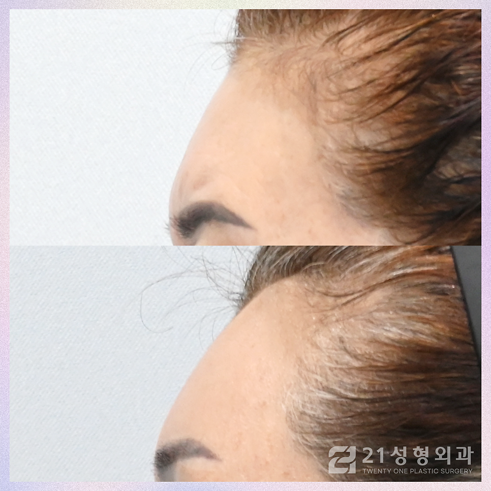 이마거상잘하는곳을 찾는 분들을 위해 관련 이미지 4