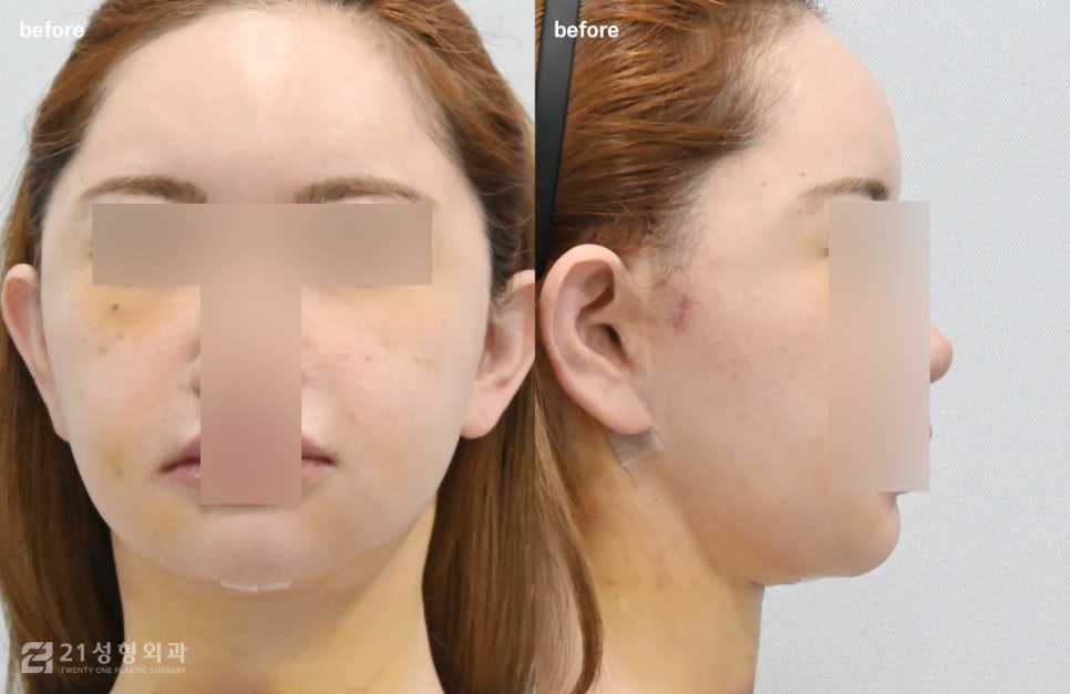 Is a Small Face and a Slim Face Shape Like Jennie’s Really Possible? image 4
