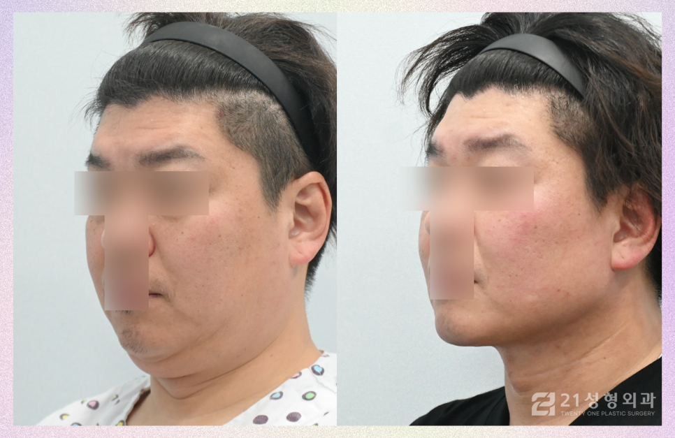 21성형외과에 사연을 들려주세요 관련 이미지 6