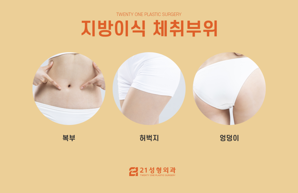 강남가슴 지방이식 선택 전 중요한 것 관련 이미지 3