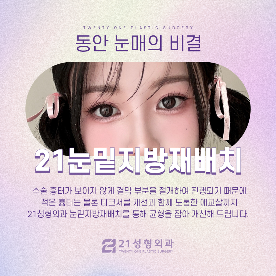 강남눈밑지방재배치잘하는곳 다른 차이는 관련 이미지 4