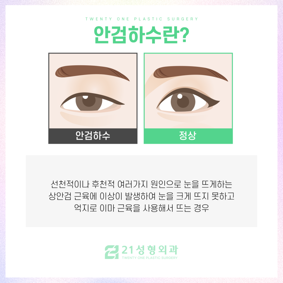 강남눈매교정잘하는곳 성공적인 결과를 위해 관련 이미지 3