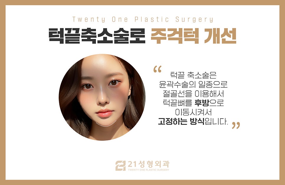 턱끝성형으로 양악 없이 주걱턱해결 관련 이미지 4