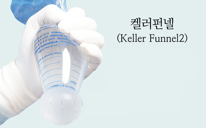 [가슴성형] 겨드랑이 절개와 흉터 관련 이미지 6