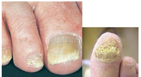 항생제의 작용기전 및 분류 관련 이미지 9